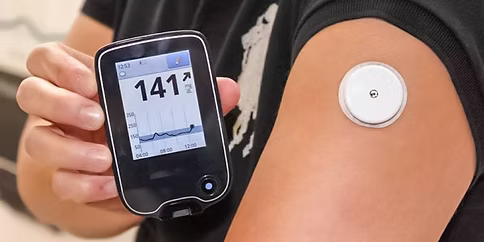 CGM Device